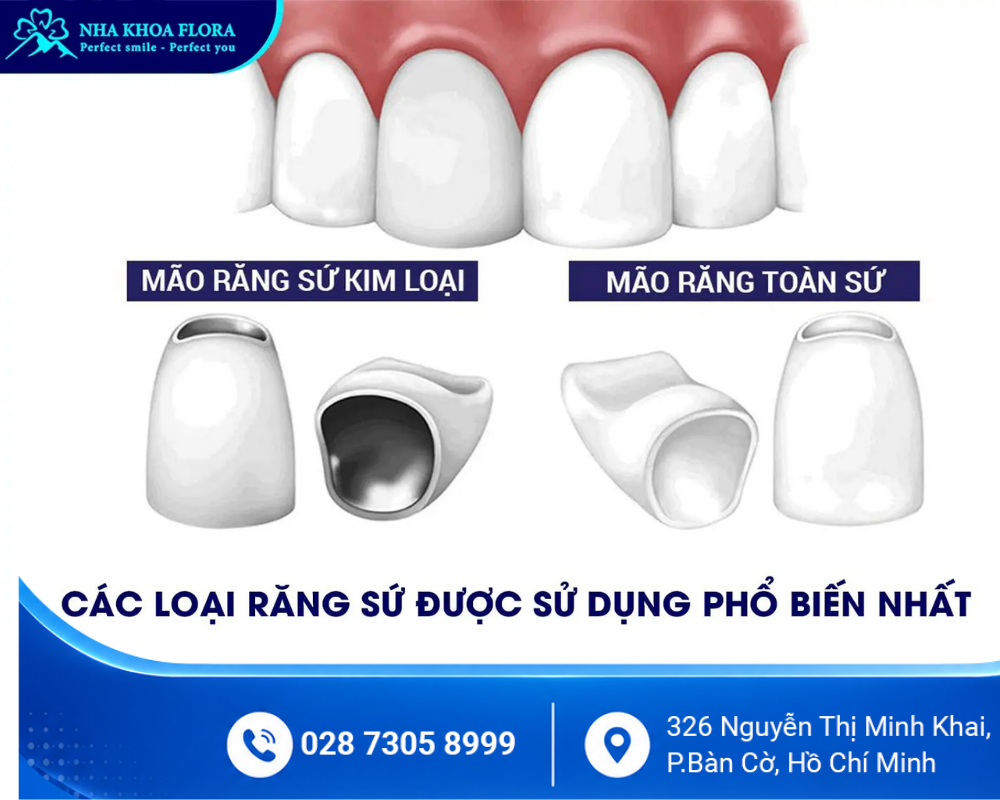 Bảng Giá 1