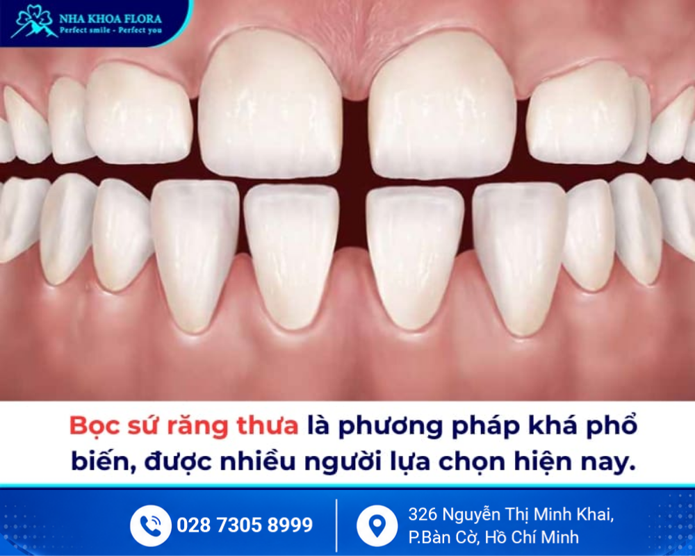 Bọc răng sứ thẩm mỹ 9