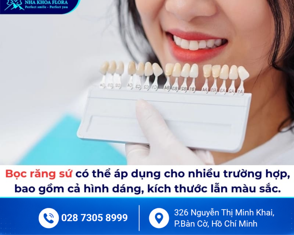 Bọc răng sứ thẩm mỹ 2