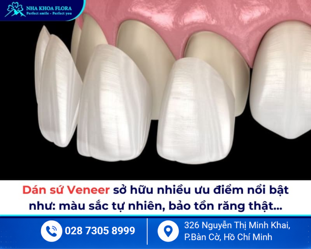 Dán sứ Veneer 2