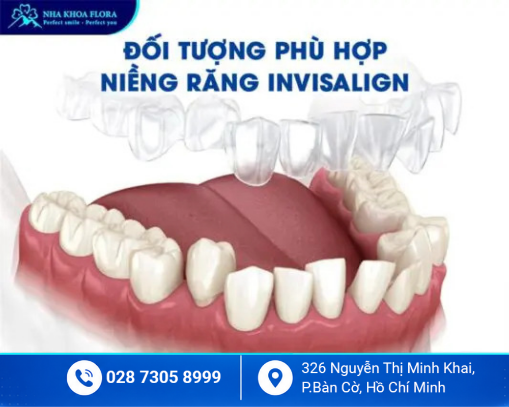 Niềng răng trong suốt Invisalign 2