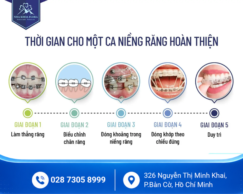 Niềng răng mắc cài 3