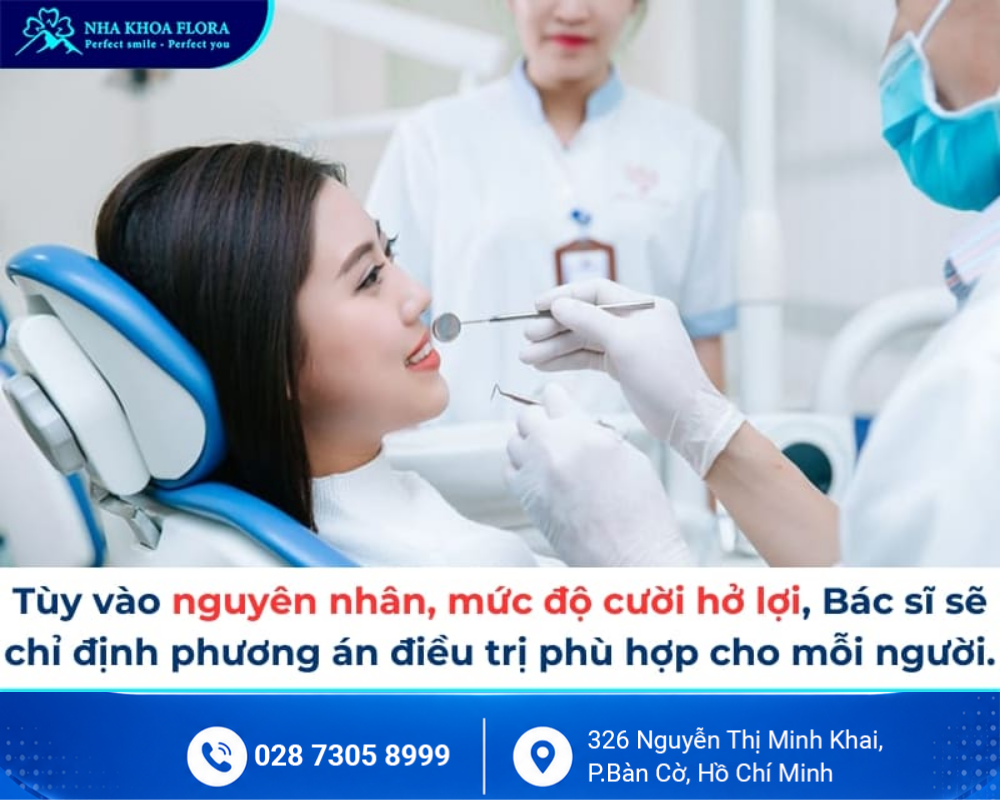 Cười hở lợi 3