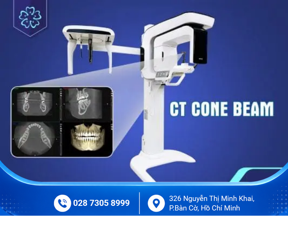 Niềng răng mắc cài 7