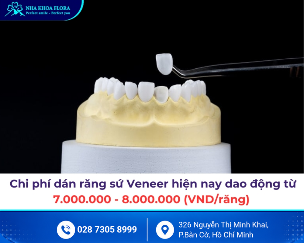 Dán sứ Veneer 5