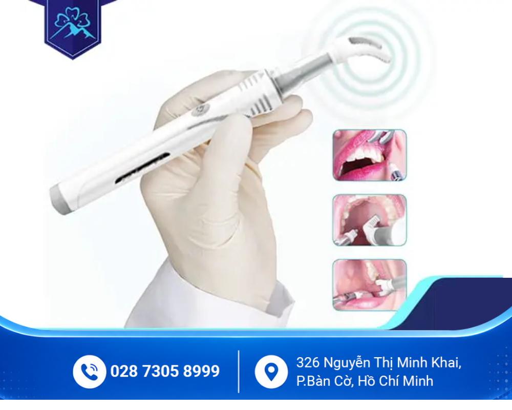 Niềng răng mắc cài 5