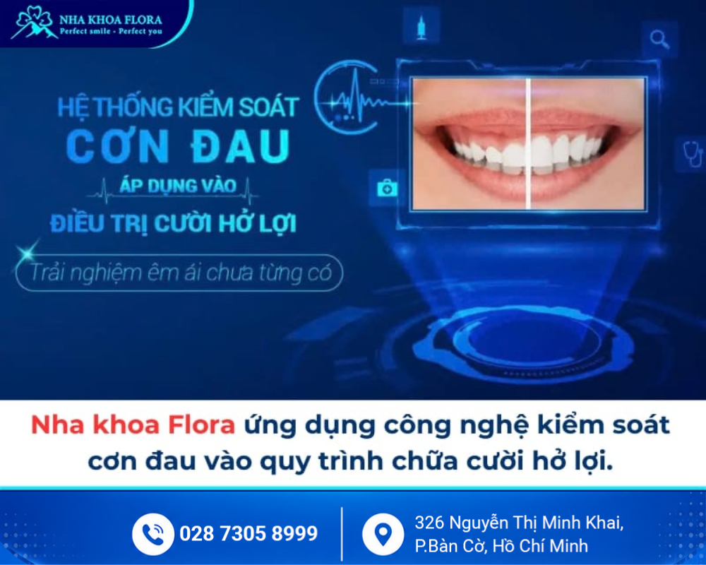 Cười hở lợi 5