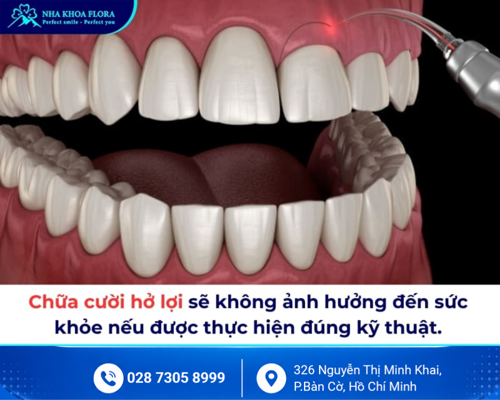 Cười hở lợi 6