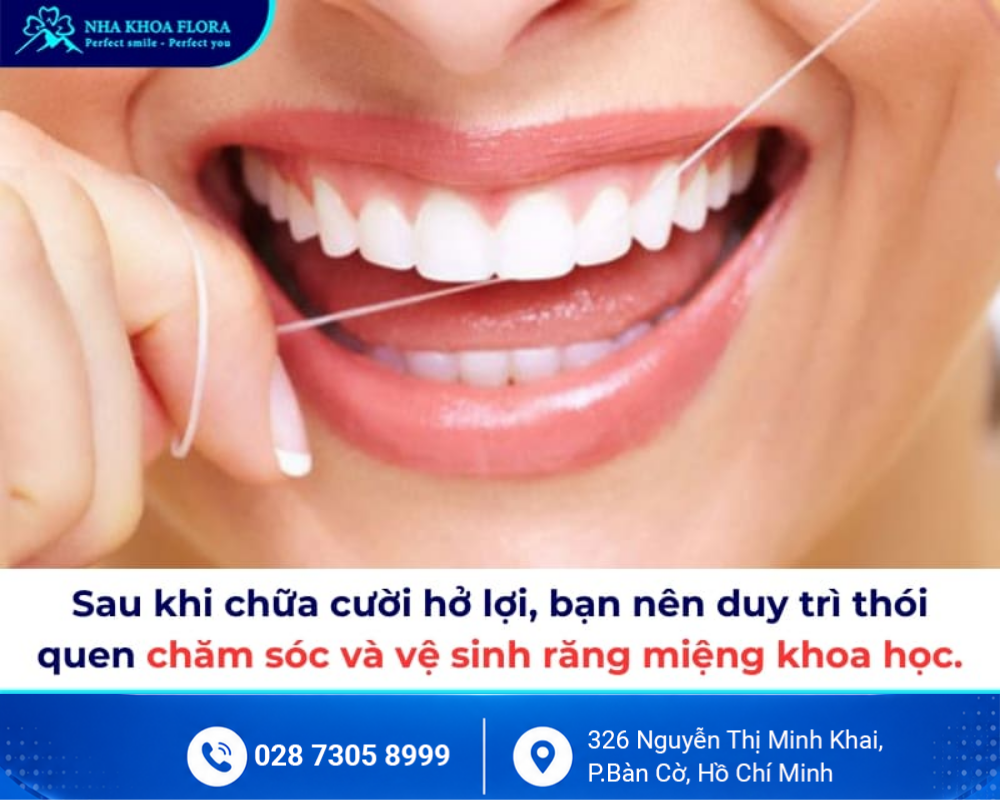 Cười hở lợi 7