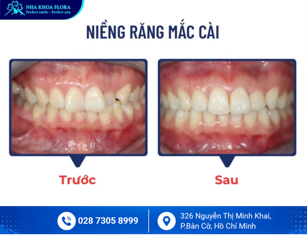 Bảng Giá 8